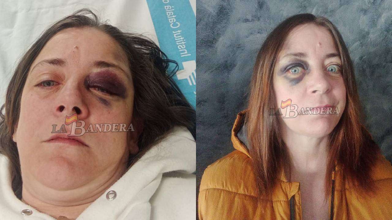 Brutal agresión a una vecina de Badalona: «Son marroquíes seguro»