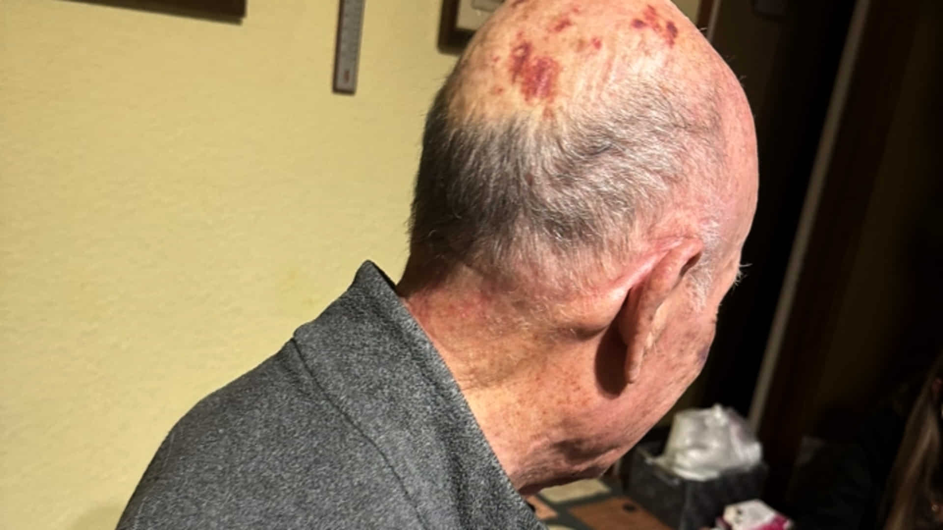 Anciano agredido en Sabadell