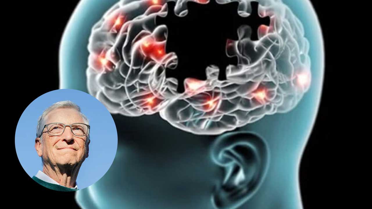 bill-gates-alzheimer