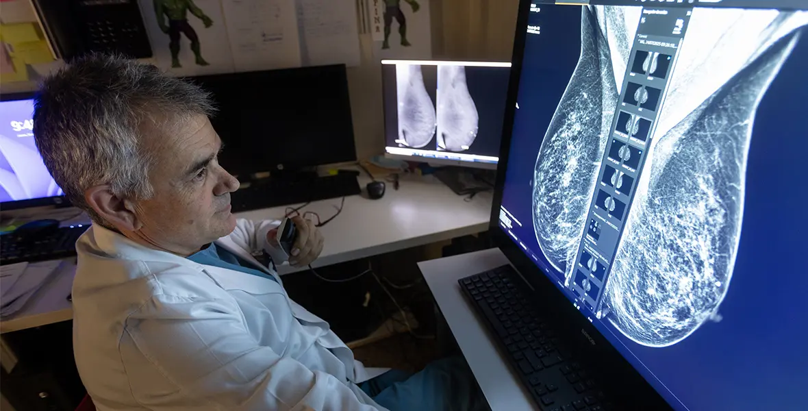 inteligencia artificial y cáncer