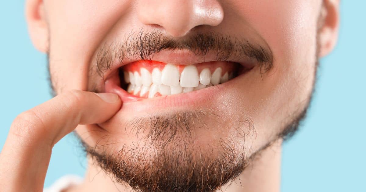 salud bucodental y estrés