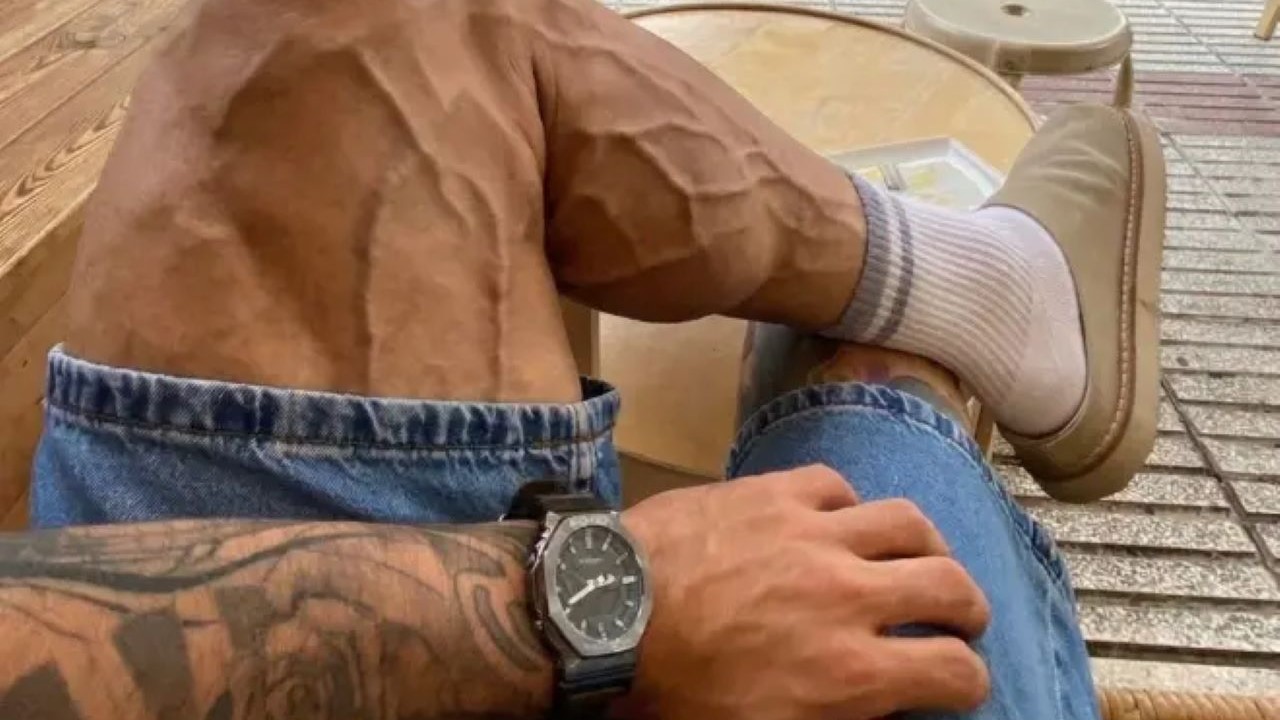 La ya famosa pierna viral/Redes sociales