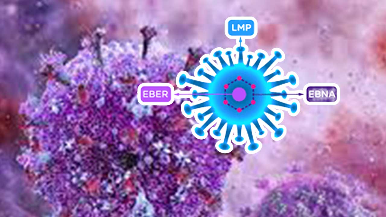 virus mononucleosis esclerosis múltiple