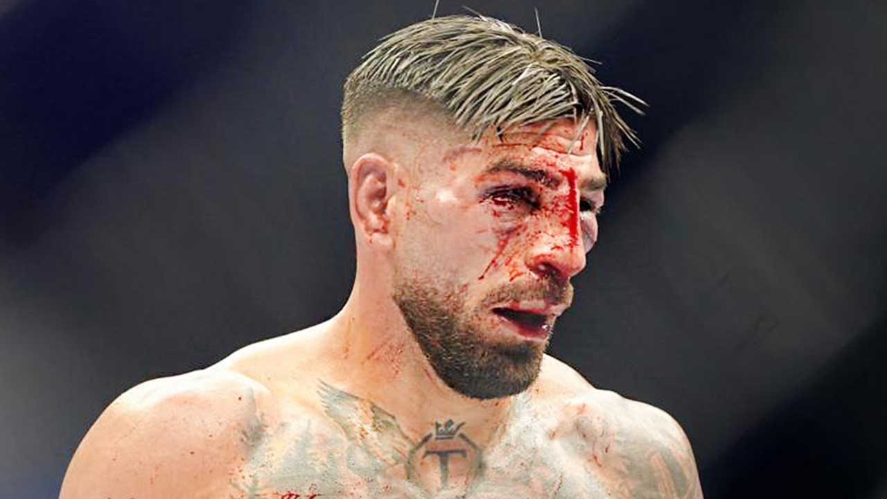 Ilia Topuria sufre graves lesiones faciales y su regreso a la UFC podría retrasarse hasta 2027